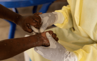 Sierra Leone Declares Public Health Emergency Over Mpox Outbreak