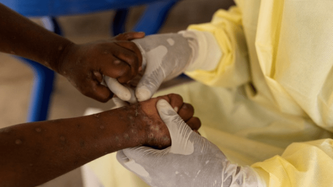 Sierra Leone Declares Public Health Emergency Over Mpox Outbreak